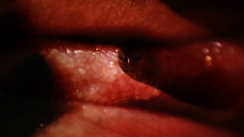 Close Up Pictures Of Human Tongue Papillae 28