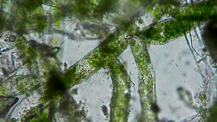 Seaweed (algae) Under Microscope, Magnification 400x Stock ...