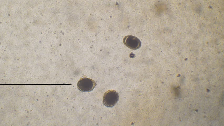 Veterinarian Looking At Roundworm Egg (Toxocara Canis) Under Microscope ...