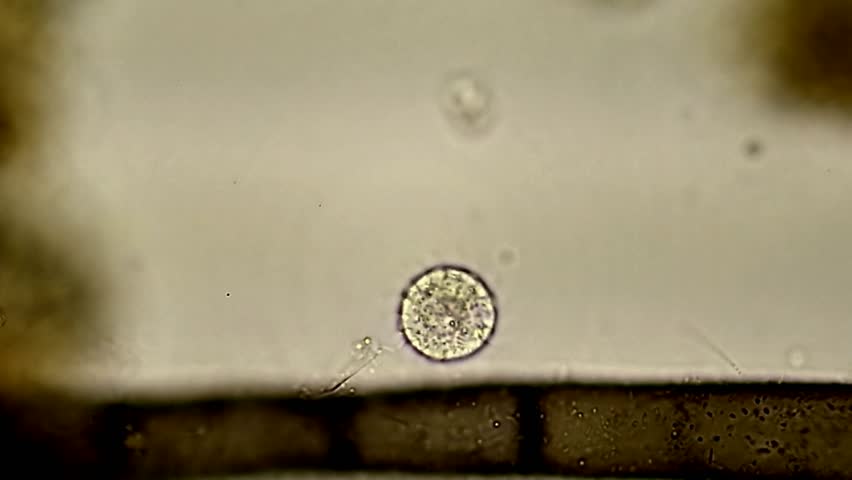 A Tiny Microscopic Protozoan Spins Round & Round By Its Cilia In A Drop ...
