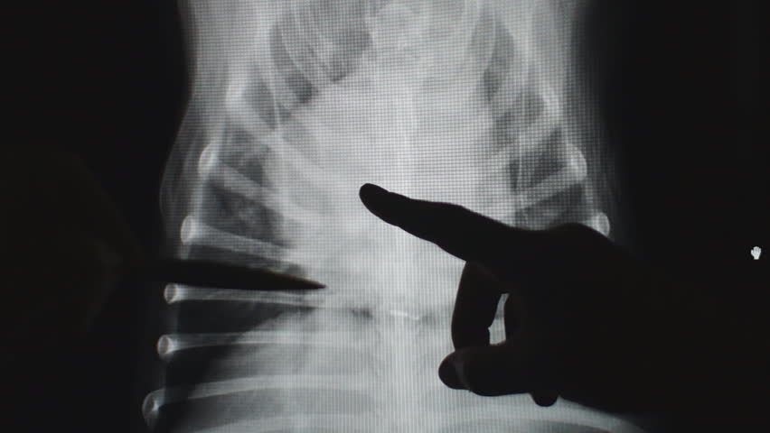 Veterinarian Explaining Canine Heart Radiograph To Pet Owner. Stock ...