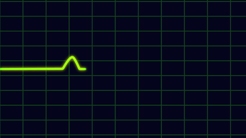 An Animated Heart Monitor EKG Flatlines. With Sound And Alpha Matte ...